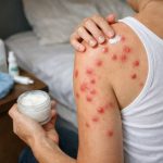 Larve de mite de bois : comment reconnaître, prévenir et traiter une infestation dans votre maison