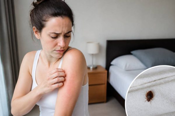 Allergies punaises de lit : symptômes, causes et solutions