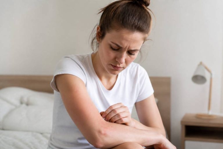 Allergie aux piqures de punaises de lit : causes, symptômes et traitement